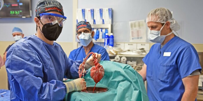 Trasplante de corazón de cerdo a un humano: «Sería difícil distinguirlos por tamaño, estructura o peso»