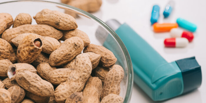 ¿Tienes alergia a los cacahuetes? Esto te puede interesar
