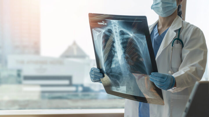 La tuberculosis sigue entre nosotros, pero se cura: claves prácticas en Euskadi