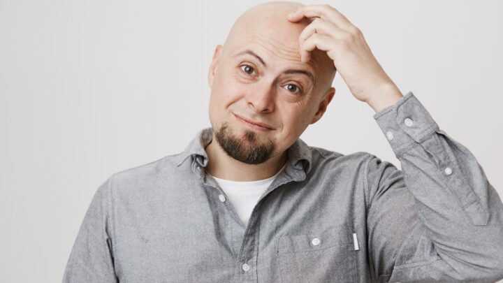 Mitos sobre la calvicie