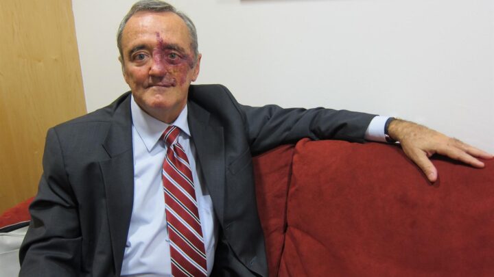 ¿Qué hay de cierto en el nuevo hallazgo contra el cáncer de páncreas?