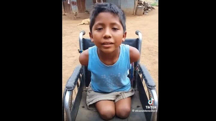 BulerIA: Emiliano, el niño sin piernas ni brazos que pide ayuda, no es real