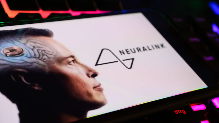 Conocemos qué hay detrás del proyecto de Elon Musk Neuralink: ¿Estamos cerca del control mental?