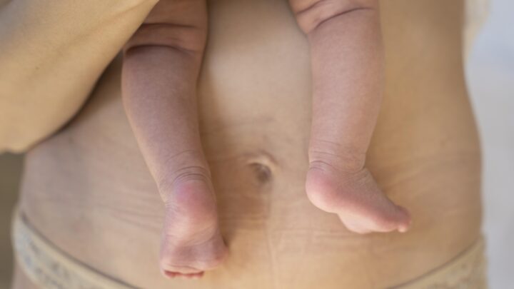 «Un abdomen plano tras el parto no equivale a un abdomen recuperado». El engaño del postparto exprés